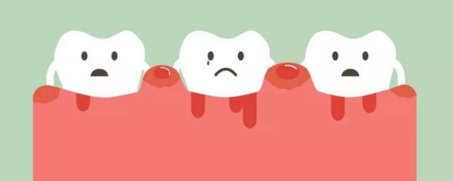 如何去除牙結石 牙結石的形成原因與處理方法