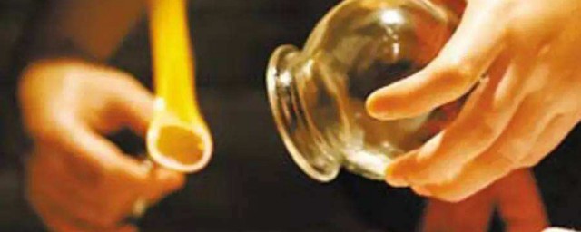 拔罐多久一次合適 一周左右一次最好