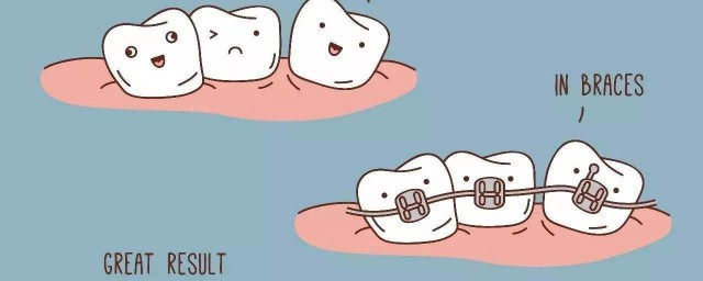 哪種動物一生都在換牙隻要牙齒受損立刻會有新的補上 人的一生中一共有多少個牙齒