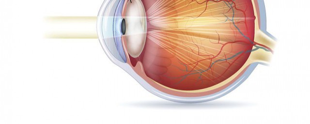 屈光不正是什麼意思 造成屈光不正的原因