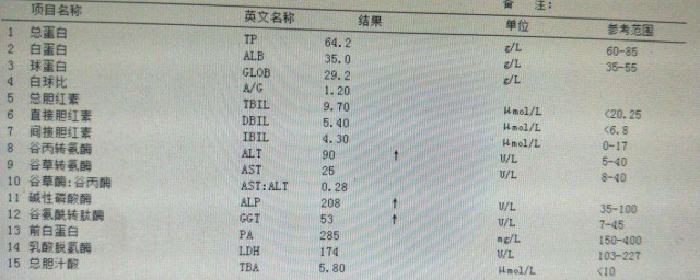 膽汁由什麼分泌 膽汁是如何產生和分泌的?