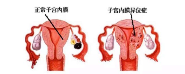 宮頸在哪個位置 平時要註意什麼