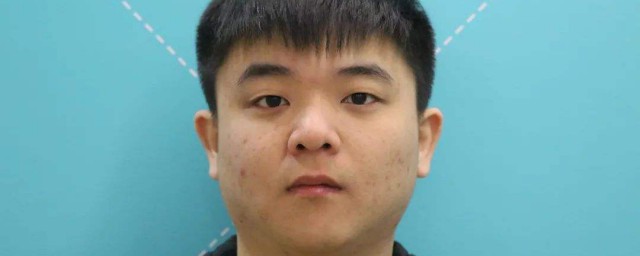 怎樣去除臉上的青春痘 有什麼小技巧