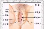 外陰炎 N76.253 細菌性外陰炎