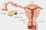 功血 功能失調性子宮出血 異常性子宮出血 功能性子宮出血