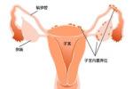 功血 功能失調性子宮出血 異常性子宮出血 功能性子宮出血