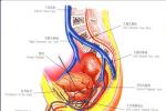 急性盆腔炎 N73.051 