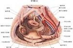 急性盆腔炎 N73.051 