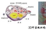 多囊卵巢綜合征 E28.253 