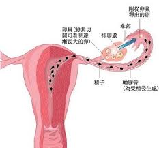 輸卵管粘連 N73.604 輸卵管粘連堵塞 Tubal adhesion