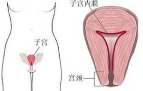 子宮積液 宮腔積液