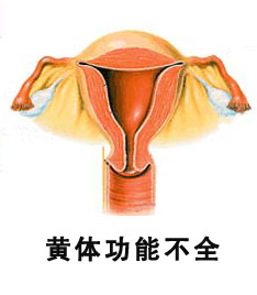 黃體功能不全 黃體功能不足