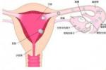 黃體功能不全 黃體功能不足