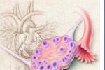卵泡囊腫 孤立性卵泡囊腫 毛囊囊腫 濾泡囊腫