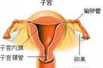 輸卵管阻塞