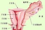 宮頸外翻 子宮頸外翻
