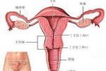 子宮發育異常 子宮畸形