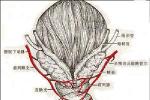 盆腔淤血綜合征 慢性盆腔被動性淤血綜合癥 卵巢 盆腔淤血