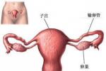 功能性子宮出血 功血 功能失調性子宮出血 異常性子宮出血