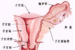 子宮內膜增生癥 無排卵功血