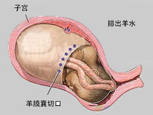 破水