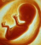 胚胎停育 胎停孕 胎停育 死胎