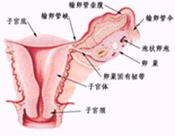 卵巢妊娠 O00.201 宮外孕 異位妊娠