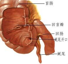 妊娠合並急性闌尾炎 孕癰