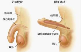 陽痿 ED 勃起功能障礙 勃起不足