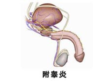 附睪炎 N45.901 