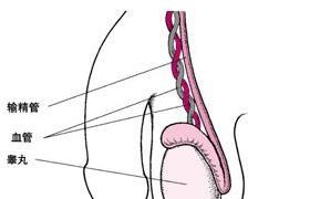 輸精管堵塞