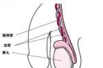 輸精管堵塞