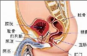 陽強 陰莖異常勃起癥 陰莖勃起異常