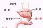 輸精管缺如 先天性輸精管缺如 先天性輸精管缺如