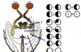 視交叉病變 Suprachiasmatic lesions