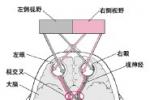 視交叉病變 Suprachiasmatic lesions