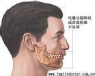 下頜後縮 Mandibular retrusion