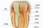 牙髓病 牙髓炎 牙髓壞死 牙髓退變