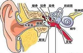 美尼爾氏綜合癥 梅尼埃病