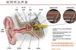 突發性耳聾 暴聾