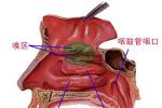 萎縮性鼻炎 臭鼻癥 鼻臭癥