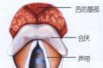 會厭炎 會厭感染