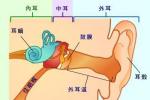 先天性耳聾 Congenital deafness 先天性聾 先天性聽力障礙