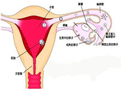 月經不調 月經失調