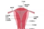 子宮內膜異位癥 子宮腺肌病 內在性子宮內膜異位癥 子宮內膜異位