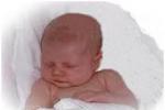 嬰兒青銅綜合征 嬰兒青銅綜合癥