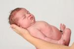 嬰兒肉毒中毒綜合征 嬰兒肉毒中毒綜合癥 嬰兒型肉毒中毒