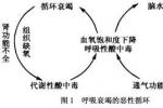 小兒急性呼吸衰竭 兒童急性呼吸衰竭