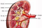 小兒急性腎小球腎炎 小兒急性鏈球菌感染後腎小球腎炎