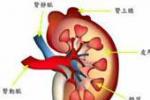 小兒急性腎小球腎炎 小兒急性鏈球菌感染後腎小球腎炎